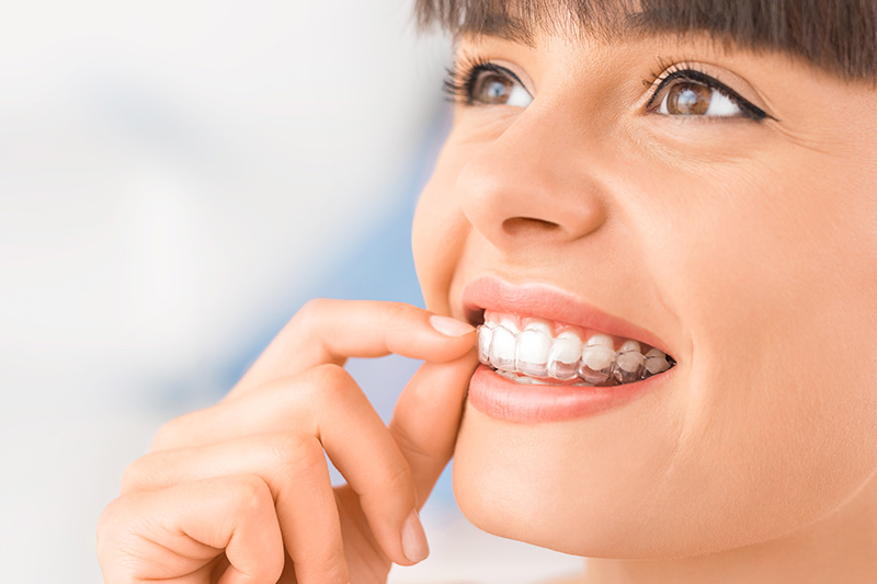 Invisalign in Bellflower