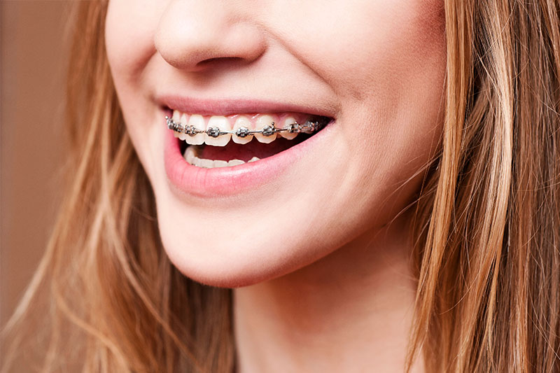 Orthodontics in Bellflower