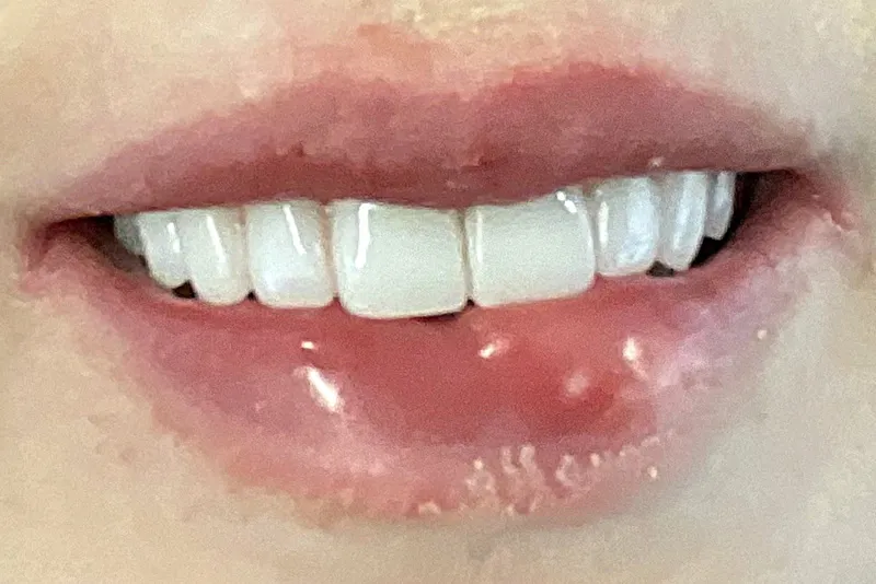 Smiling mouth with visible teeth