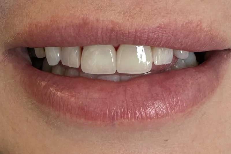 Natural teeth and lips close-up