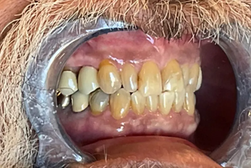 Open mouth showing yellowed teeth