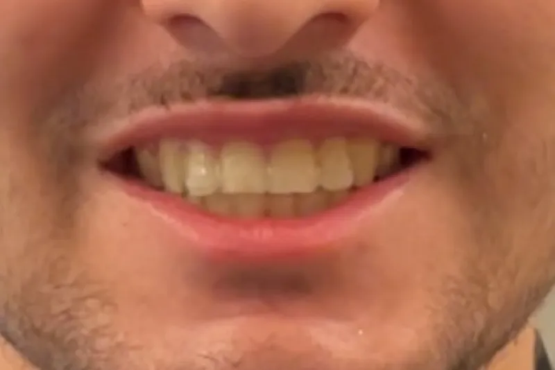Close-up of a smiling mouth