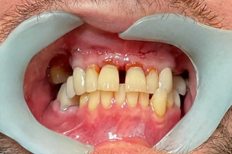Dental examination with mouth open