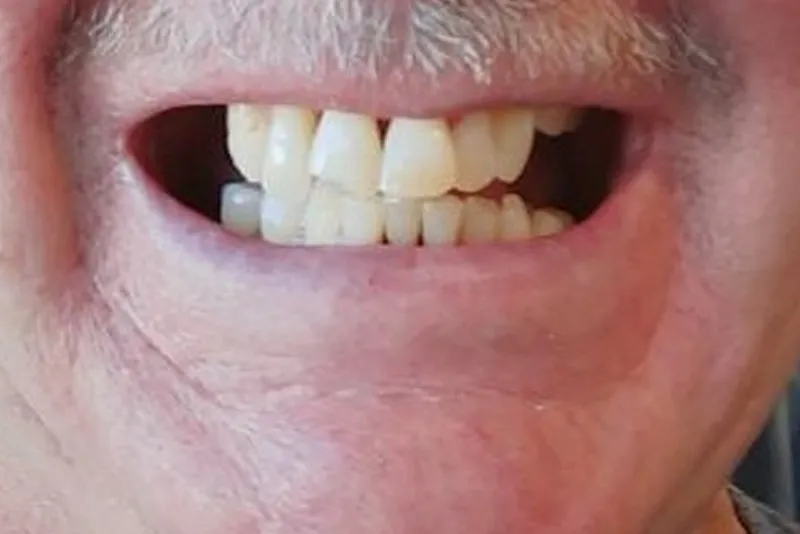 Close-up of a smiling mouth