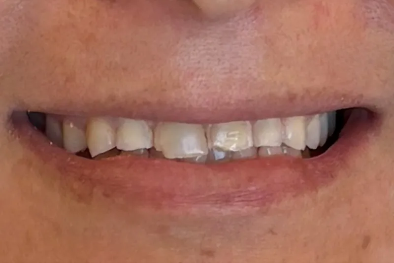 Close-up of a smiling mouth