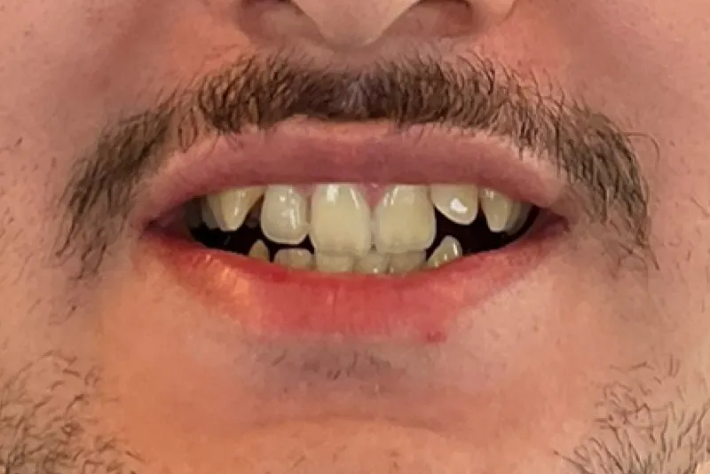 Partially open lips showing teeth
