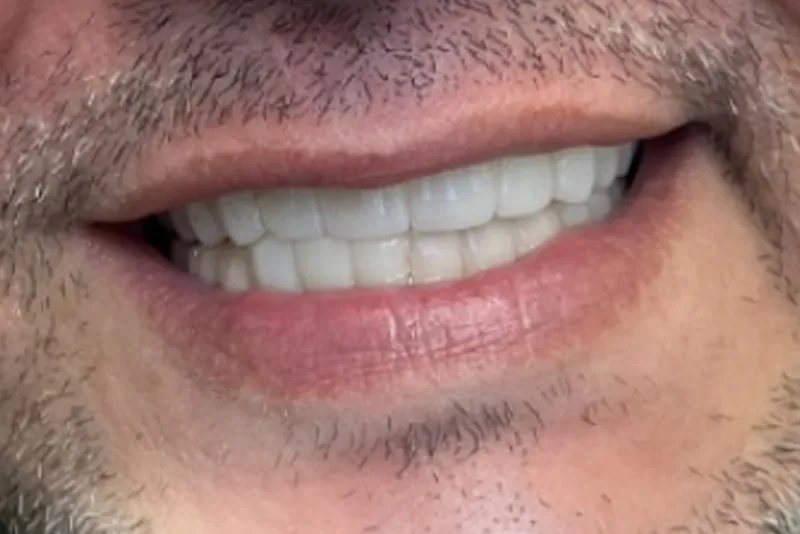 Man's smile with trimmed facial hair