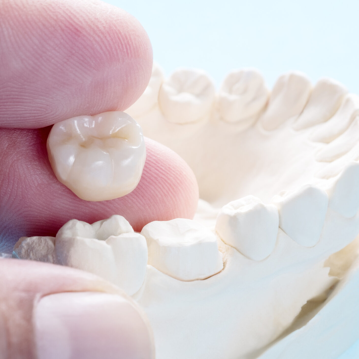 Tooth model with removable crown